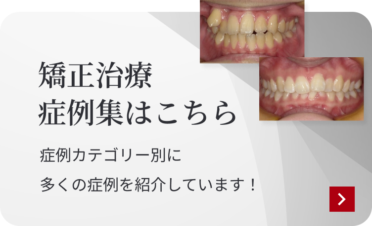 矯正治療症例集はこちら 症例カテゴリー別に多くの症例を紹介しています！