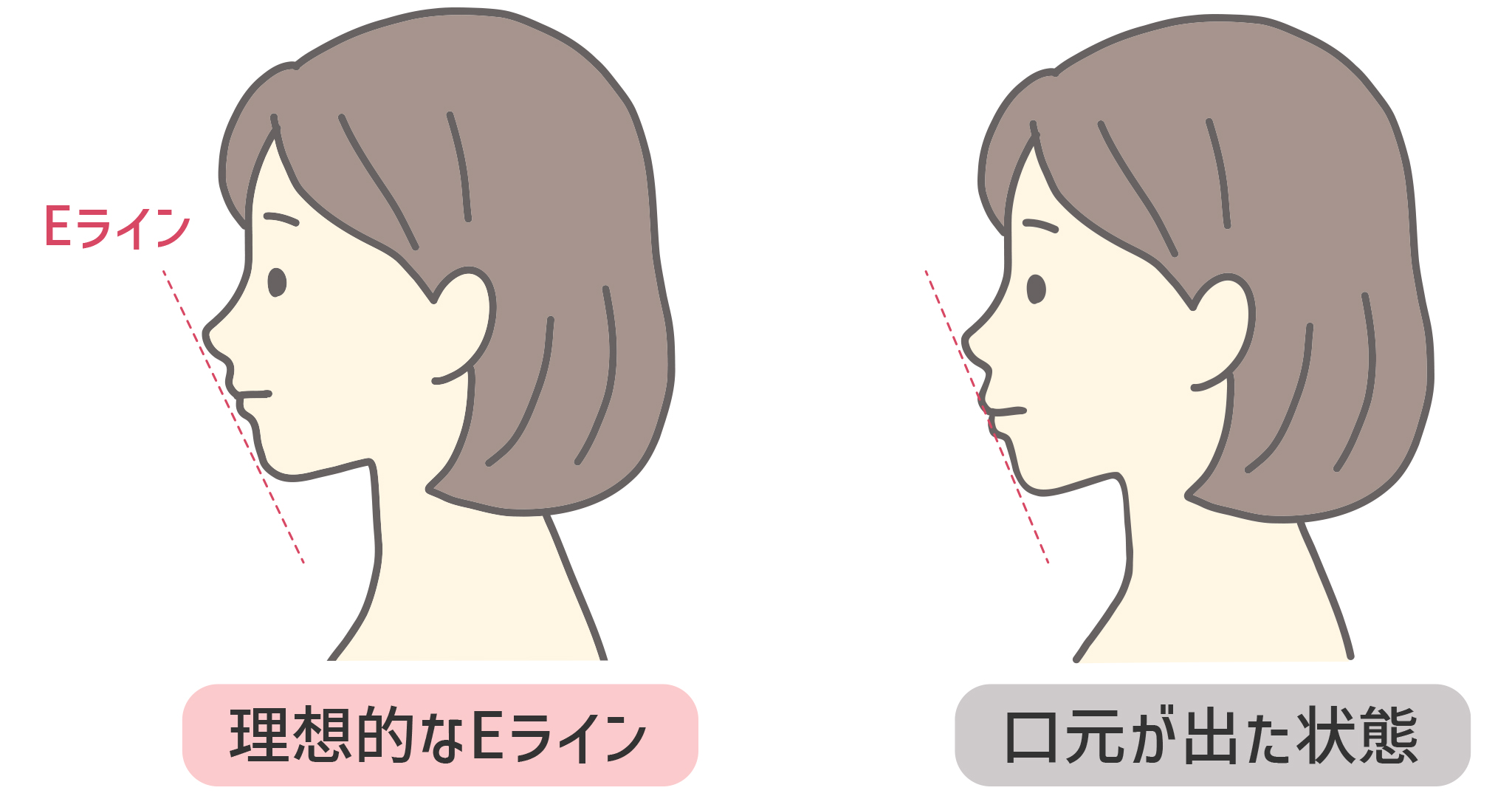 Eライン