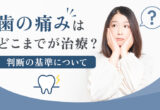歯の治療判断
