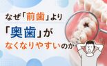 なぜ「前歯」より「奥歯」がなくなりやすいのか
