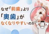 なぜ「前歯」より「奥歯」がなくなりやすいのか