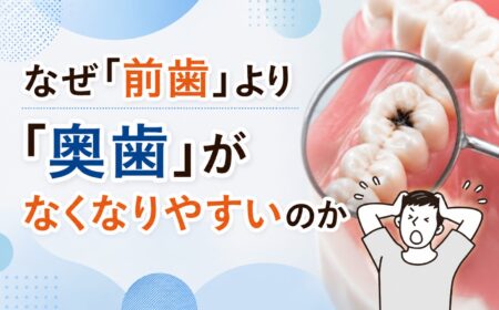 なぜ「前歯」より「奥歯」がなくなりやすいのか