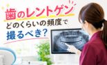 歯のレントゲン、どのくらいの頻度で撮るべき？