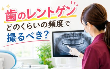 歯のレントゲン、どのくらいの頻度で撮るべき？