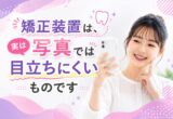 矯正装置、写真にすると意外と分からないものです