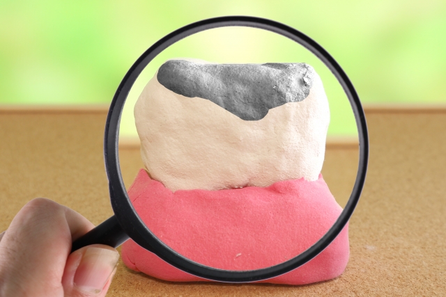 神経を取った歯が黒くなる理由とは