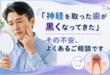 「神経を取った歯が黒くなってきた」その不安、よくあるご相談です