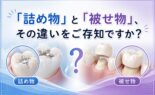 「詰め物」と「被せ物」、その違いをご存知ですか？
