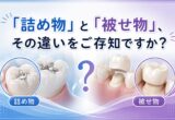 「詰め物」と「被せ物」、その違いをご存知ですか？