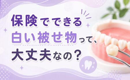 保険でできる白い被せ物って、大丈夫なの？