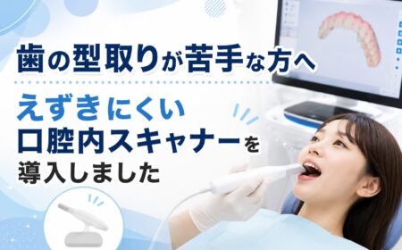歯の型取りが苦手な方へ｜えずきにくい口腔内スキャナーを導入しました