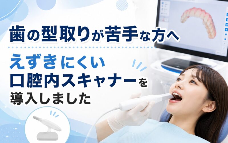 歯の型取りが苦手な方へ｜えずきにくい口腔内スキャナーを導入しました