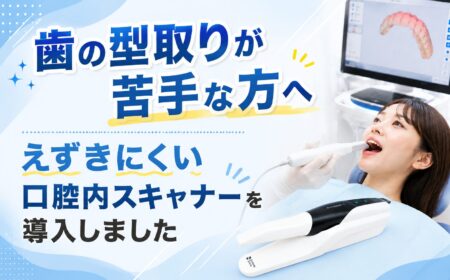 歯の型取りが苦手な方へ　えずきにくい口腔内スキャナーを導入しました