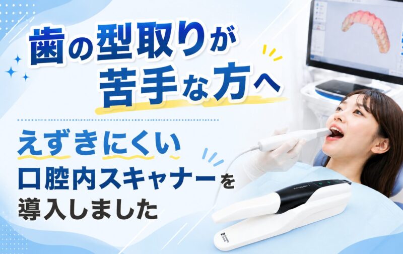 歯の型取りが苦手な方へ　えずきにくい口腔内スキャナーを導入しました