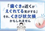 「歯ぐきの近くがえぐれてる気がする」それ、くさび状欠損かもしれません