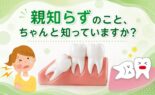 親知らずのこと、ちゃんと知っていますか？