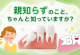 親知らずのこと、ちゃんと知っていますか？