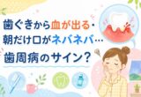 歯ぐきから血が出る・朝だけ口がネバネバ…歯周病のサイン？