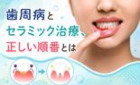歯周病とセラミック治療、正しい順番とは