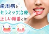 歯周病とセラミック治療、正しい順番とは