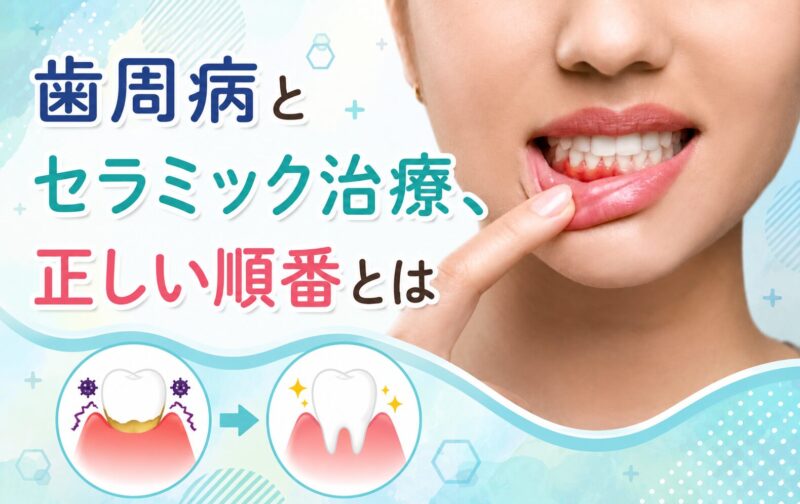 歯周病とセラミック治療、正しい順番とは