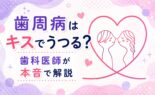 歯周病はキスでうつる？歯科医師が本音で解説