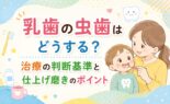 乳歯の虫歯はどうする？治療の判断基準と仕上げ磨きのポイント